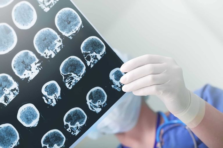 Opiates and Opiate Treatment