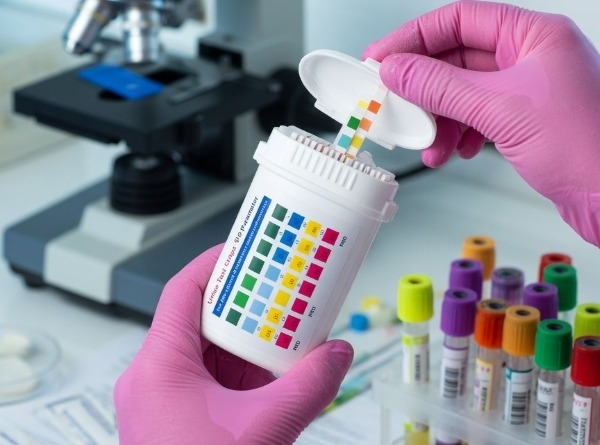How Kratom Detection Differs Across Testing Methods